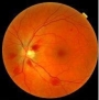 A retinal scan image
